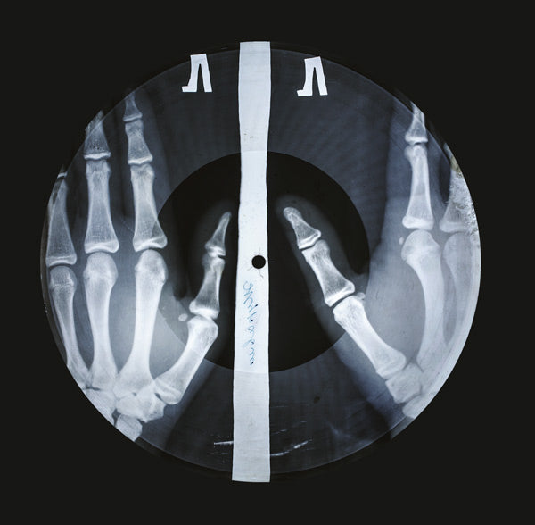 X-Ray Audio: The Strange Story of Soviet Music on the Bone